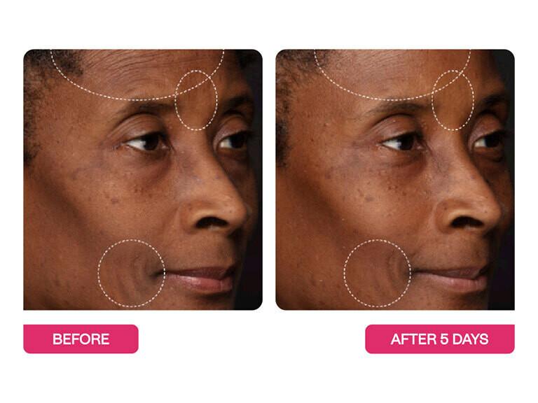 Resized Media/BSTAMST1065663 BSC33 5