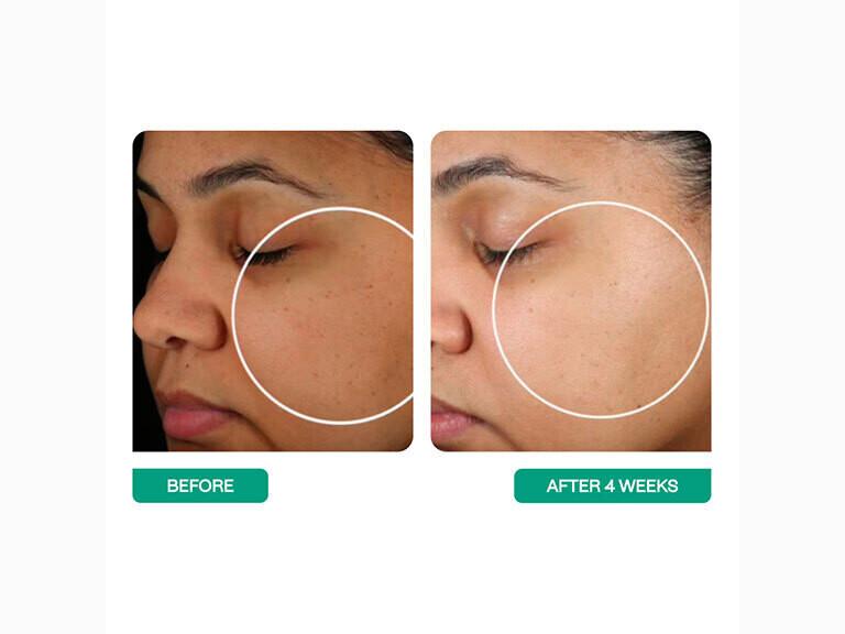 Resized Media/BSTAMST1065664 BSC55 5