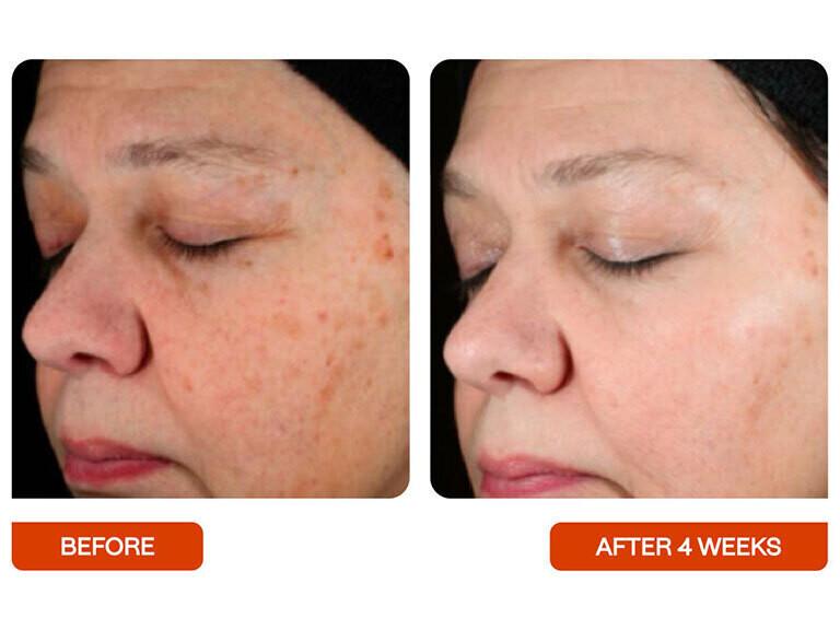 Resized Media/BeautyStat Universal Skin Refiner Full Size 5